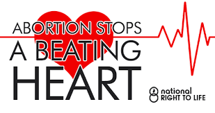 abortion stops a beating heart