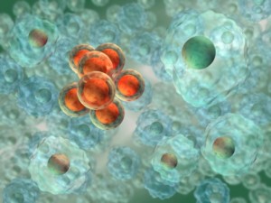 Transformed eukaryotic cells