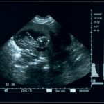 ultrasound