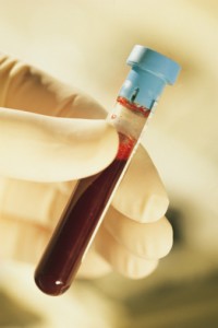 blood vials